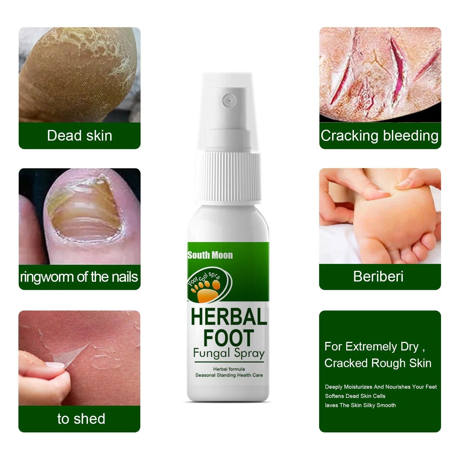 30ml foot skin care spray bottle for nourishing and hydrating dry feet
