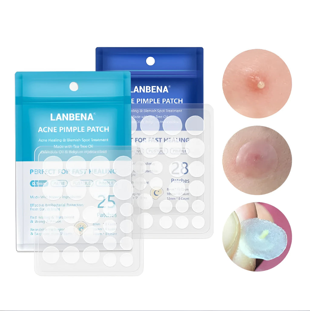Acne stickers with tea tree oil and Calendula oil for treating blemishes and fading acne marks on scar-prone skin
