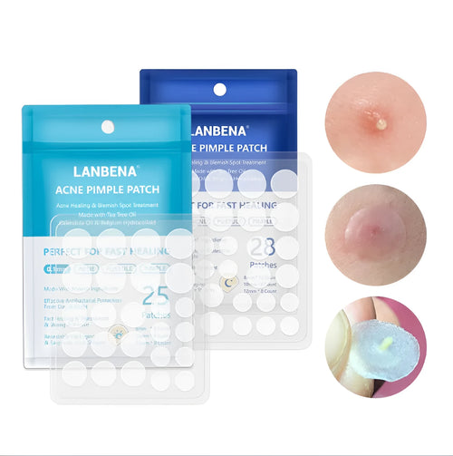 Acne stickers with tea tree oil and Calendula oil for treating blemishes and fading acne marks on scar-prone skin