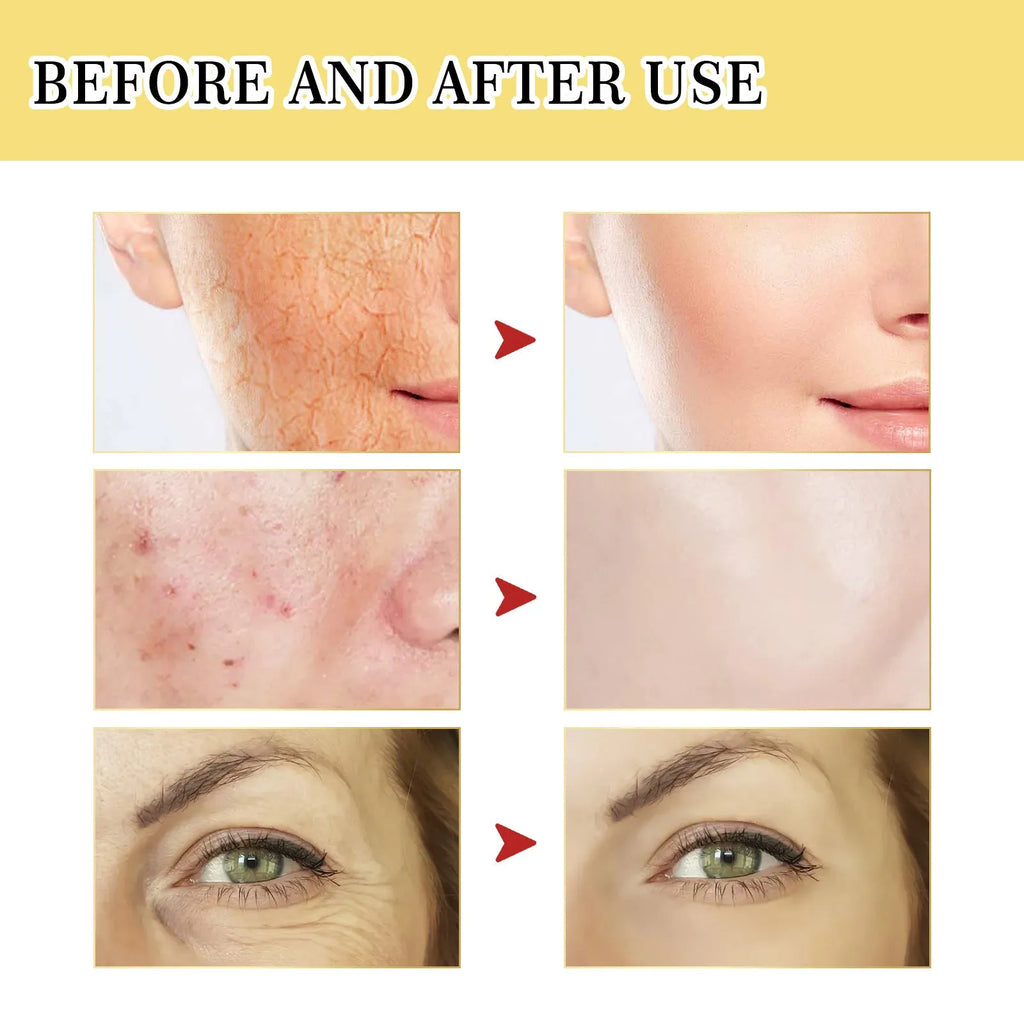 Snail serum collagen facial treatment bottle with 100ml content for hydrating and brightening skincare
