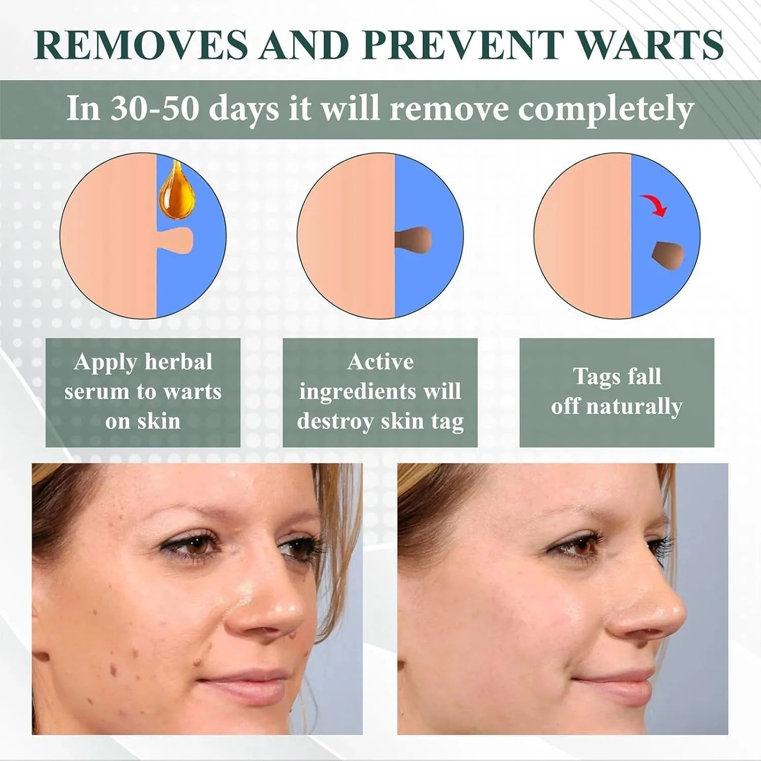 Natureerase 45g tube of hydrating mole removal gel for face and body treatment