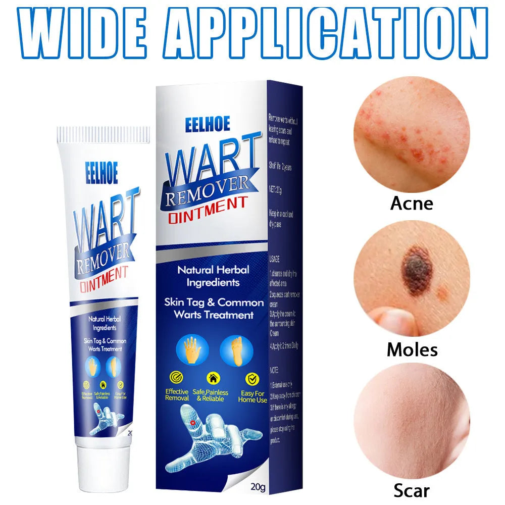 Zhongcao Keyou Liquid Skin Warts Cream 22g tube for wart removing treatment