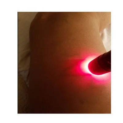 Black aluminium alloy Smart Vein Locator handheld medical device for vein illumination.