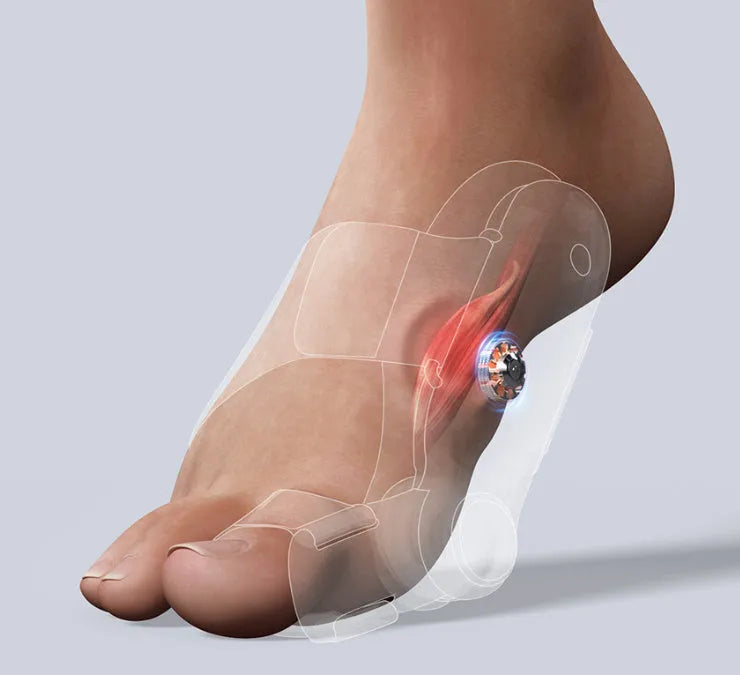 White plastic electric adjustable hallux valgus toe separator with USB Type-C charging cable