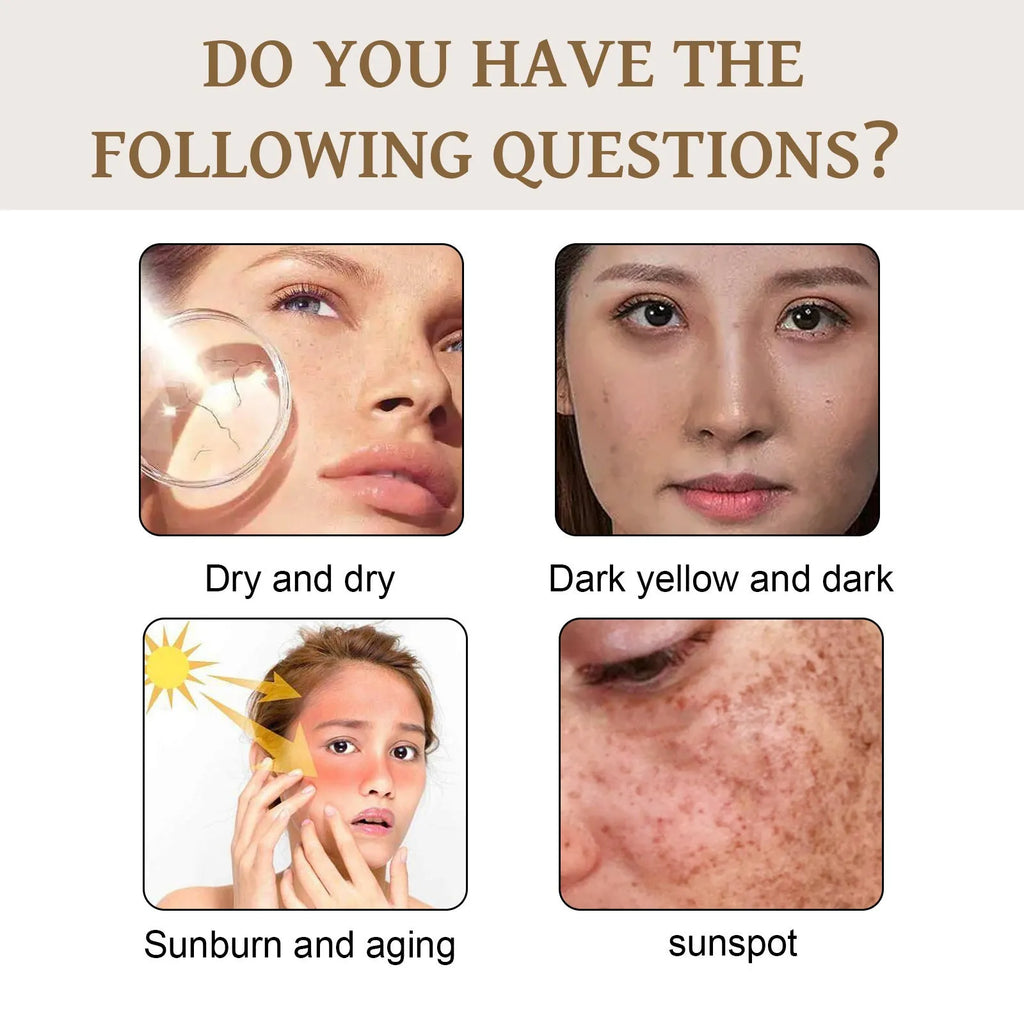 Probiotics protective cream in 50g container for skin tone protection