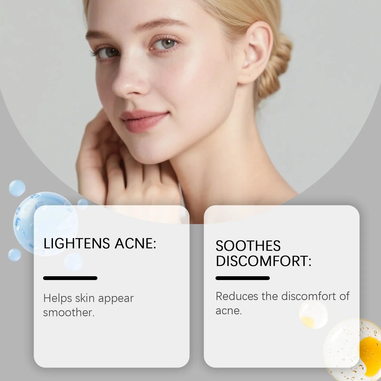 Package of 80 transparent hydrocolloid acne patches for facial blemish treatment.