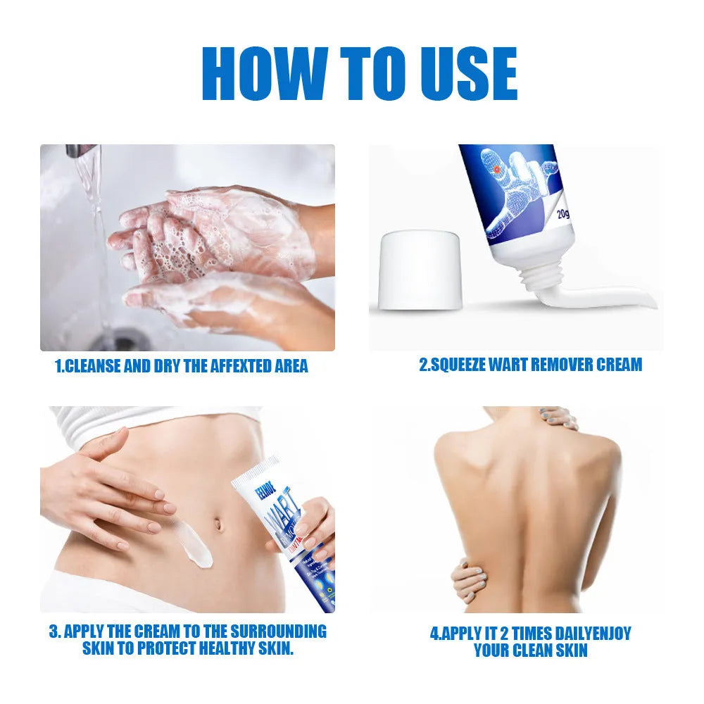 Zhongcao Keyou Liquid Skin Warts Cream 22g tube for wart removing treatment