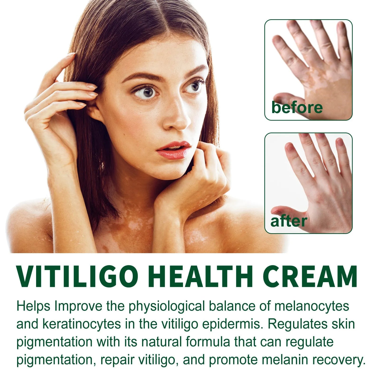 35g body care nursing cream for skin cleansing, moisturising and orange peel tissue treatment