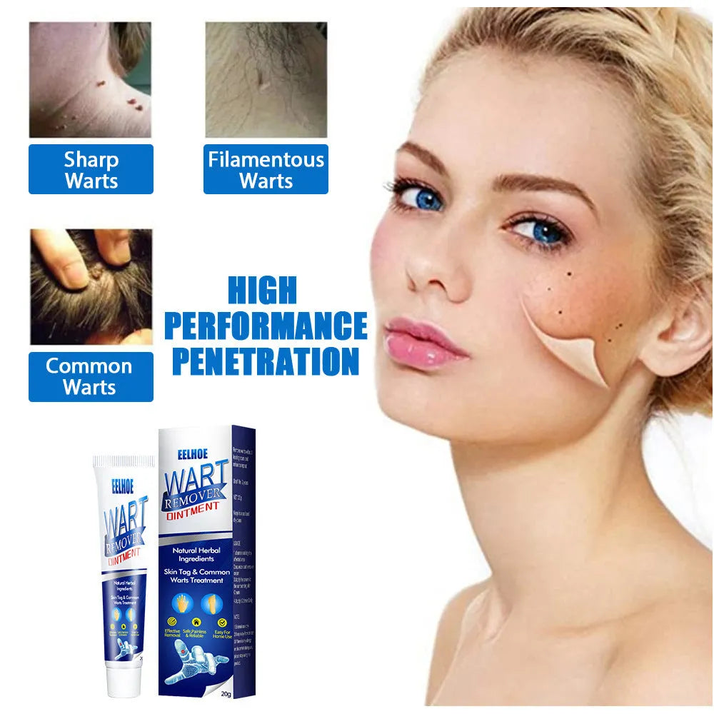 Zhongcao Keyou Liquid Skin Warts Cream 22g tube for wart removing treatment